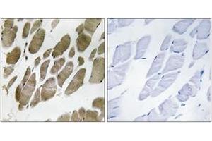 Immunohistochemistry analysis of paraffin-embedded human skeletal muscle tissue, using NMU Antibody. (Neuromedin U 抗体  (AA 125-174))
