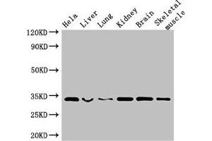 Western Blot Positive WB detected in: Hela whole cell lysate, Mouse liver tissue, Mouse lung tissue, Mouse kidney tissue, Mouse brain tissue, Mouse skeletal muscle tissue All lanes: CNN2 antibody at 2. (CNN2 抗体  (AA 2-309))