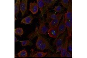 Immunofluorescence staining of methanol-fixed HeLa cells using LC3A /Apg-8 antibody (E021402, Red) (MAP1LC3A 抗体)