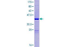 Oral Cancer Overexpressed 1 (ORAOV1) (AA 1-137) protein (GST tag)
