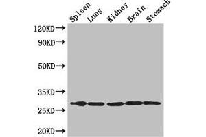 Western Blot Positive WB detected in: Mouse spleen tissue, , Mouse lung tissue, Mouse kidney tissue, Mouse brain tissue, Mouse stomach tissue All lanes: RTP3 antibody at 3 μg/mL Secondary Goat polyclonal to rabbit IgG at 1/50000 dilution Predicted band size: 28 kDa Observed band size: 28 kDa (RTP3 抗体  (AA 1-211))