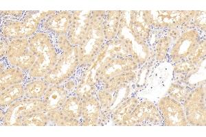 Detection of IK in Human Kidney Tissue using Polyclonal Antibody to IK Cytokine, Down Regulator Of HLA II (IK) (Protein Red (IK) (AA 1-192) 抗体)