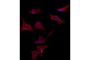 ABIN6265587 and ABIN6272983 staining HepG2 by IF/ICC. (PLIN3 抗体)