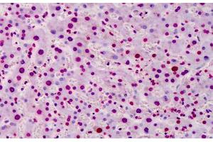 Human Liver: Formalin-Fixed, Paraffin-Embedded (FFPE) (Poly-ADP-Ribose 抗体)