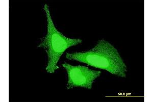 Immunofluorescence of monoclonal antibody to ZAK on HeLa cell. (ZAK 抗体  (AA 1-120))