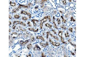 IHC analysis of ATG7 using anti-ATG7 antibody (ABIN7603109). (ATG7 抗体  (N-Term))