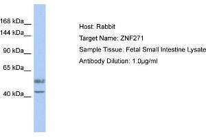 Host: Rabbit Target Name: ZNF271 Sample Type: Fetal Small Intestine lysates Antibody Dilution: 1. (ZNF271 抗体  (Middle Region))