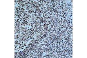 Immunohistochemical analysis of Cleaved PARP1 staining in human tonsil formalin fixed paraffin embedded tissue section. (PARP1 抗体  (cleaved))