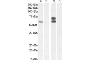 (ABIN570827) (2 μg/mL) staining of Jurkat nuclear lysate (A) + Peptide (B), and (0. (IKZF4 抗体  (Internal Region))