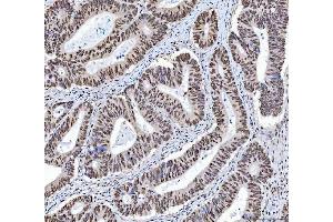 IHC analysis of XRCC4 using anti-XRCC4 antibody (ABIN7599168).