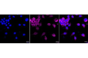Immunocytochemical staining of Hela cells with RALBP1 antibody (ABIN7800126), 1:1,000). (Recombinant RALBP1 抗体)