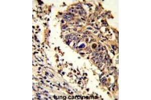 Immunohistochemistry (IHC) image for anti-LUC7-Like (LUC7L) antibody (ABIN3002860) (LUC7L 抗体)