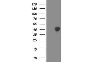 Western Blotting (WB) image for anti-Leucine Carboxyl Methyltransferase 1 (LCMT1) antibody (ABIN1499108) (LCMT1 抗体)
