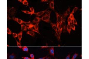 Immunofluorescence analysis of NIH/3T3 cells using SLC29A1 Polyclonal Antibody at dilution of 1:100. (SLC29A1 抗体)