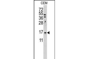 Western blot analysis of anti-LSM1 Antibody (C-term) (ABIN389386 and ABIN2839481) in CEM cell line lysates (35 μg/lane). (LSM1 抗体  (C-Term))