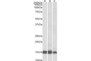 AP32739PU-N FABP3 Antibody staining of Human (A), Mouse (B) and Rat(C) Heart lysates at 0. (FABP3 抗体)