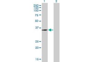 Western Blot analysis of ZMYND12 expression in transfected 293T cell line by ZMYND12 MaxPab polyclonal antibody. (ZMYND12 抗体  (AA 1-365))