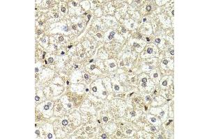 Immunohistochemistry of paraffin-embedded human liver injury using LMNB2 Antibody. (Lamin B2 抗体  (AA 341-620))