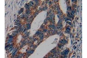 Immunohistochemistry (IHC) image for anti-Corticotropin Releasing Hormone (CRH) (AA 40-195) antibody (ABIN7429697)