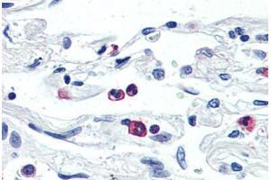 Anti-LGR6 antibody  ABIN1049008 IHC staining of human neutrophils. (LGR6 抗体  (Internal Region))