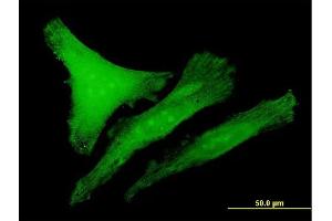 Immunofluorescence of purified MaxPab antibody to CDKN1B on HeLa cell. (CDKN1B 抗体  (AA 1-198))