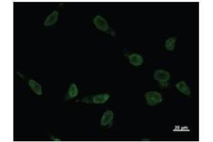Immunostaining analysis in HeLa cells. (VAX2 抗体)