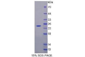SDS-PAGE analysis of Human HPCAL4 Protein. (HPCAL4 蛋白)