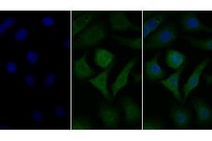 Detection of GLa in Human Hela cell using Polyclonal Antibody to Galactosidase Alpha (GLa) (GLA 抗体  (AA 1-80))