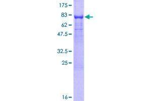 TMX3 Protein (AA 1-454) (GST tag)