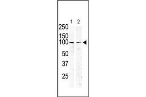 Image no. 1 for anti-Mast/stem Cell Growth Factor Receptor (KIT) (N-Term) antibody (ABIN359890) (KIT 抗体  (N-Term))