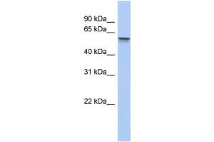 WB Suggested Anti-ALDH6A1 Antibody Titration:  0. (ALDH6A1 抗体  (Middle Region))