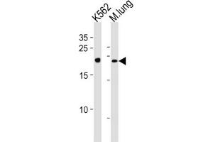 Western Blotting (WB) image for anti-Core-Binding Factor, beta Subunit (CBFB) antibody (ABIN3002868) (CBFB 抗体)