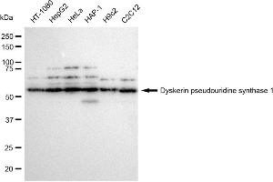 Western blotting analysis using Dyskerin pseudouridine synthase 1 antibody (ABIN7798407).