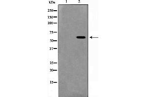 Western blot analysis on HeLa cell lysate using MUTYH Antibody,The lane on the left is treated with the antigen-specific peptide.