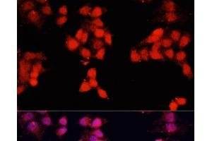Immunofluorescence analysis of HeLa cells using ENO3 Polyclonal Antibody at dilution of 1:100. (ENO3 抗体)