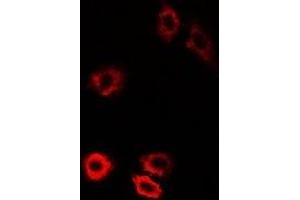 Immunofluorescent analysis of HIWI1 staining in U2OS cells. (PIWIL1 抗体)