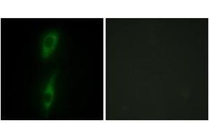Immunofluorescence (IF) image for anti-Activin A Receptor Type II-Like 1 (ACVRL1) (AA 196-245) antibody (ABIN1533718)