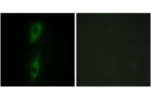 Immunofluorescence analysis of HeLa cells, using ACVL1 Antibody. (ACVRL1 抗体  (AA 196-245))