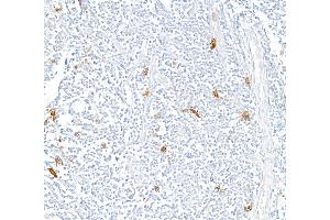 Immunohistochemistry (IHC) image for anti-Tumor Necrosis Factor Receptor Superfamily, Member 8 (TNFRSF8) (AA 19-385) antibody (ABIN7454029)