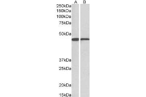Antibody (0. (ACAT1 抗体  (AA 253-266))