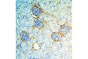 IHC analysis of ANXA3 using anti-ANXA3 antibody (ABIN6719269). (Annexin A3 抗体  (AA 23-323))