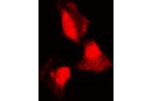 Immunofluorescent analysis of SGK1 staining in HepG2 cells. (SGK1 抗体  (Center))