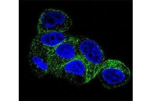 Confocal immunofluorescent analysis of b-Tubulin antibody with HepG2 cells followed by Alexa Fluor 488-conjugated goat anti-mouse lgG (green). (TUBB1 抗体)