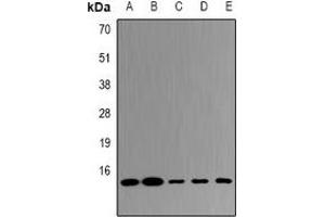 Western blot analysis of UBE2D4 expression in HepG2 (A), MCF7 (B), mouse liver (C), mouse kidney (D), rat lung (E) whole cell lysates. (UBE2D4 抗体)