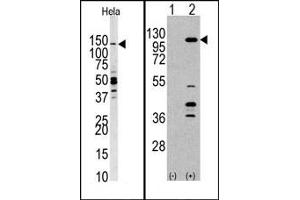 Image no. 1 for anti-Phosphoinositide-3-Kinase, Catalytic, gamma Polypeptide (PIK3CG) (C-Term) antibody (ABIN360712) (PIK3 gamma 抗体  (C-Term))