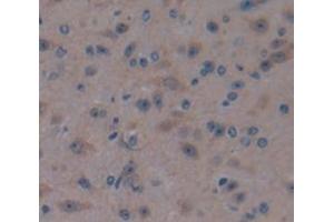 Used in DAB staining on fromalin fixed paraffin- embedded Kidney tissue (CRYGS 抗体  (AA 2-178))