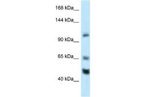 WB Suggested Anti-Rest Antibody Titration: 1. (REST 抗体  (Middle Region))