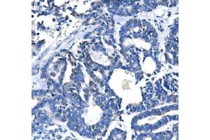 IHC analysis of METTL3 using anti-METTL3 antibody (ABIN7602808). (METTL3 抗体  (C-Term))