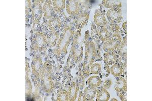 Immunohistochemistry of paraffin-embedded rat kidney using PDGFB Antibody (ABIN1874072) at dilution of 1:100 (40x lens). (PDGFB 抗体)