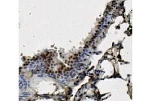 anti-Heterogeneous Nuclear Ribonucleoprotein D (HNRNPD) (AA 88-246) antibody
